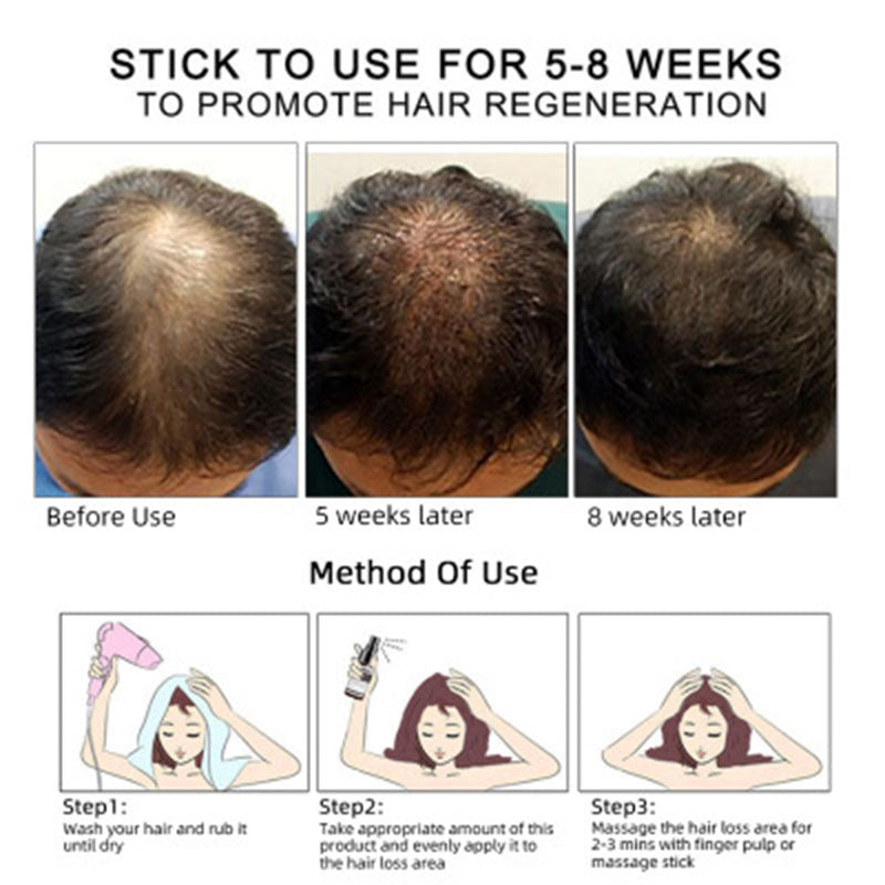 Master locs hair growth oil