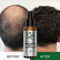 PURC Rosemary Hair Care Essential Oil Ginger Head